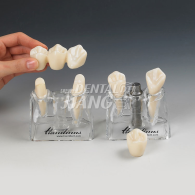 Tooth Model 3000 #HL-63000