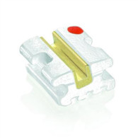 Gold Ceramic Bracket (Roth)