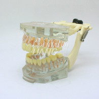 Transparent Model DM 101 #HL-60101