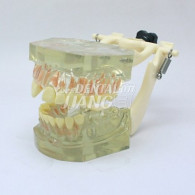 Transparent Model DM 104 #HL-60104