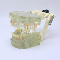 Transparent Model DM 106 #HL-60106