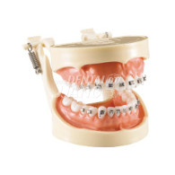 Orthodontic Model #HL-60024 (Hard)