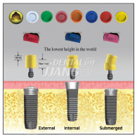 Kerator locator Attachment (Internal)