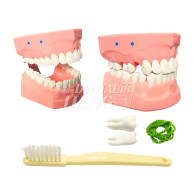 Dental Model (환자 설명용 모델) #AT-A9