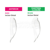 Bioclear Anterior Matrix Refill