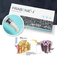 Frabone-I