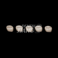 NuSmile ZR Crowns Refill 제2구치 #Narrow [Extra Light]