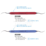 [단종] Mini Five Rigid Curette_Plastic Handle