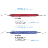 After Five Rigid Curette_Plastic Handle